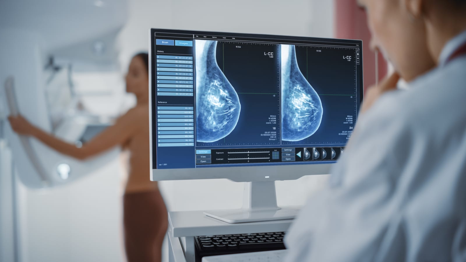 Profissional analisa imagens de mamografia em um monitor